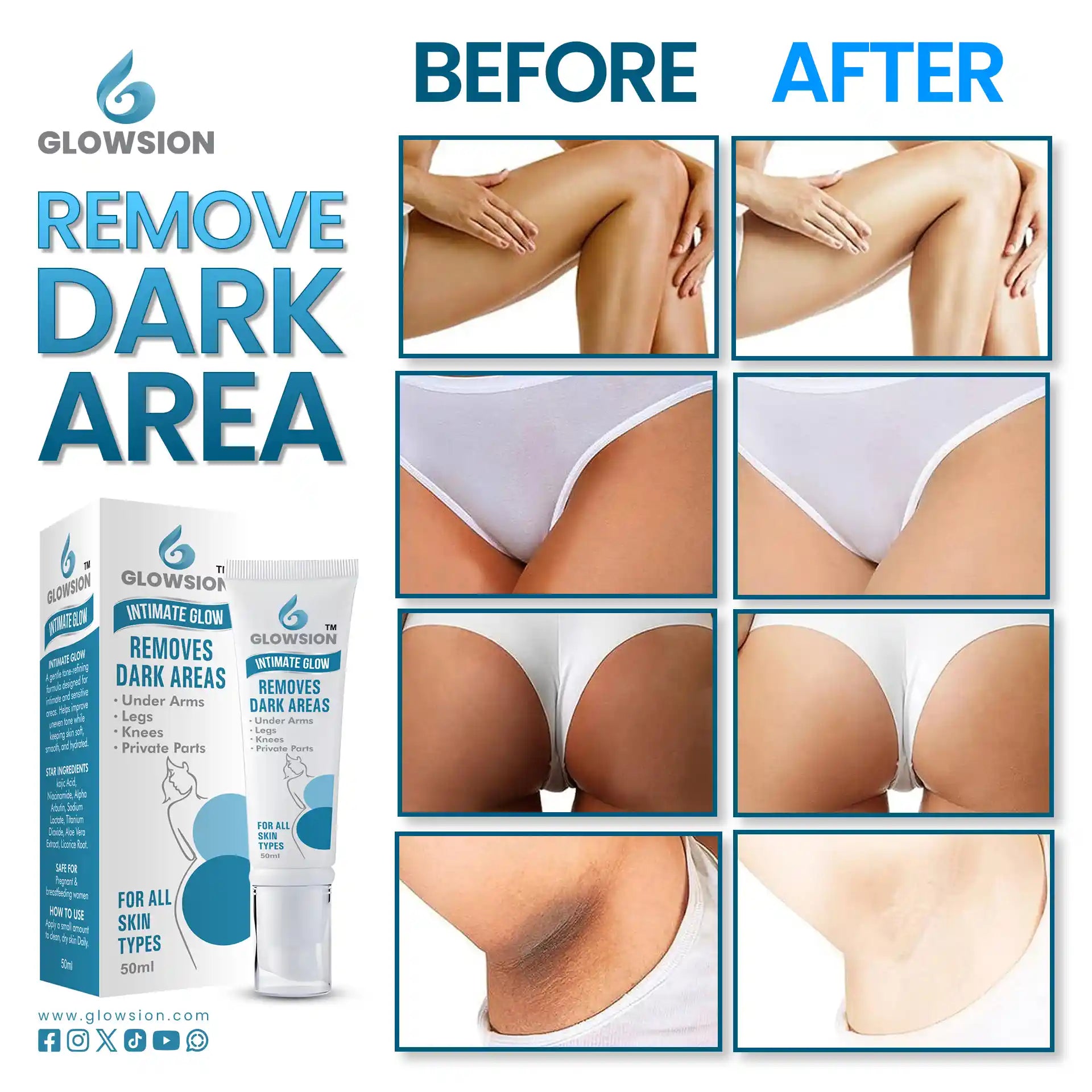 Before and after comparison of dark area removal with Glowsion product.